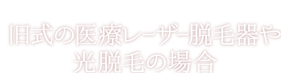 他の脱毛と何が違うの？ 旧式の医療レーザー脱毛器や 光脱毛の場合