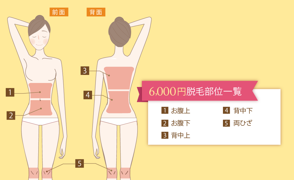 6,000円プラン脱毛部位一覧
