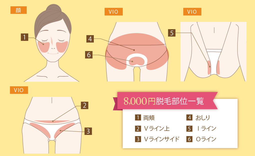 8,000円プラン脱毛部位一覧